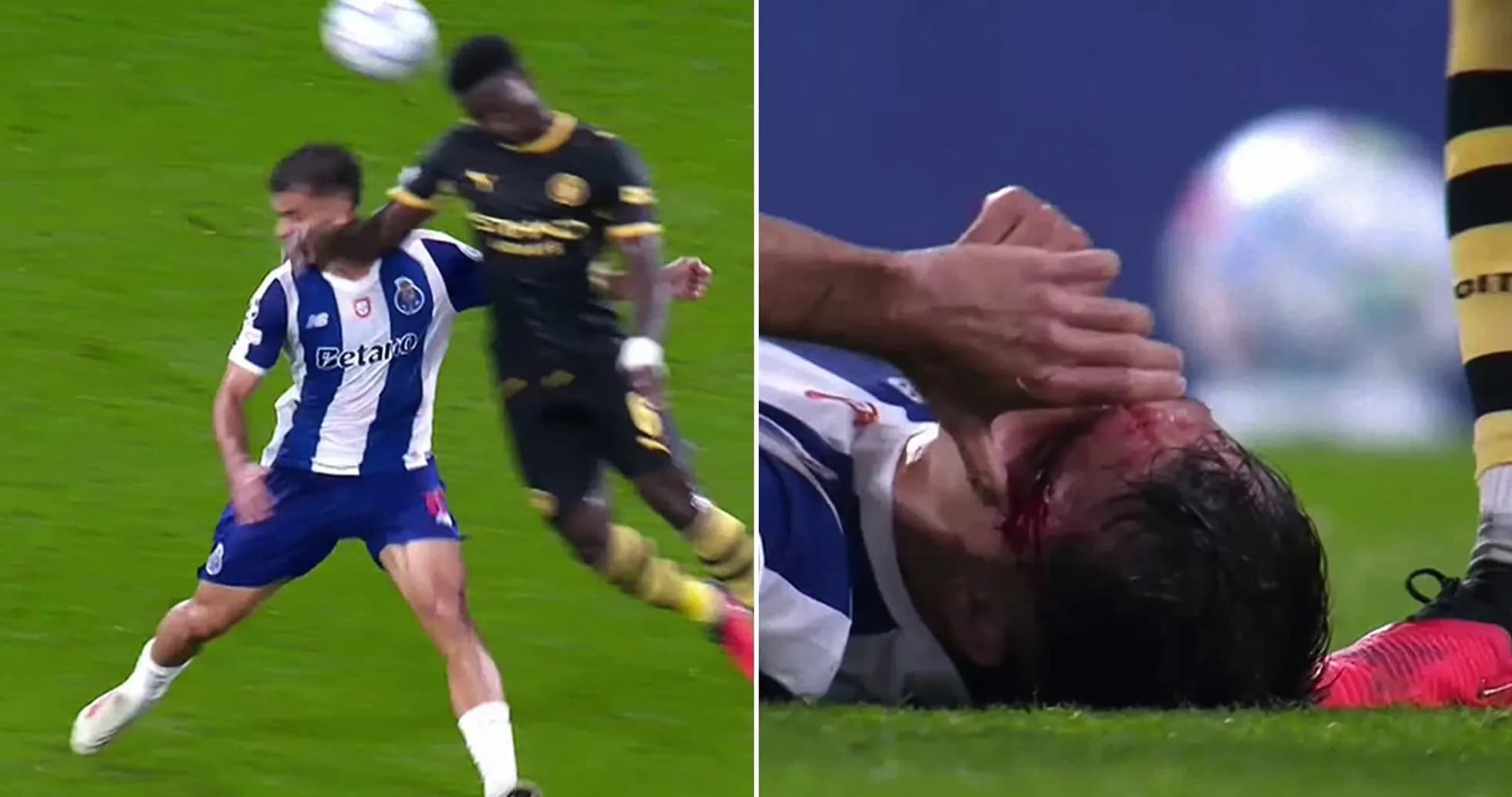 Player injured on the ground after collision