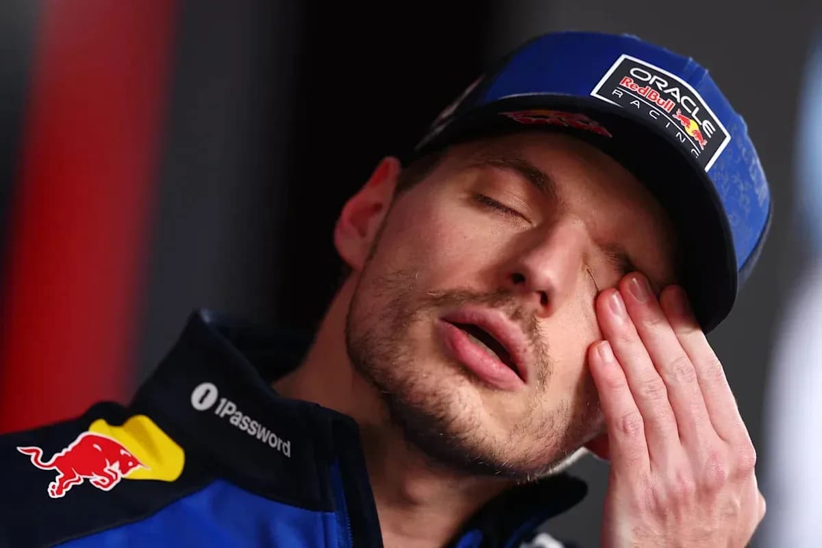 Driver resting with hand on face during press event Driver resting with hand on face during press event